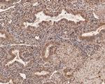 PFKFB2 Antibody in Immunohistochemistry (Paraffin) (IHC (P))