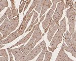 PFKFB2 Antibody in Immunohistochemistry (Paraffin) (IHC (P))