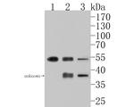 PFKFB2 Antibody in Western Blot (WB)