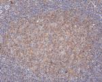 PIP5K1A Antibody in Immunohistochemistry (Paraffin) (IHC (P))