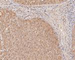 PIP5K1A Antibody in Immunohistochemistry (Paraffin) (IHC (P))