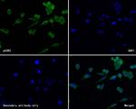 p53R2 Antibody in Immunocytochemistry (ICC/IF)