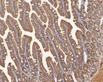 p53R2 Antibody in Immunohistochemistry (Paraffin) (IHC (P))