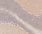 p53R2 Antibody in Immunohistochemistry (Paraffin) (IHC (P))