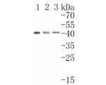 p53R2 Antibody in Western Blot (WB)