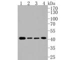 Presenilin 1 Antibody in Western Blot (WB)