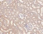 UCRC Antibody in Immunohistochemistry (Paraffin) (IHC (P))