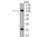 CER1 Antibody in Western Blot (WB)