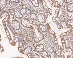 Ribulose-phosphate 3-epimerase Antibody in Immunohistochemistry (Paraffin) (IHC (P))