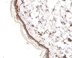 PSMD10 Antibody in Immunohistochemistry (Paraffin) (IHC (P))