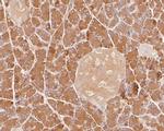 PNLIP Antibody in Immunohistochemistry (Paraffin) (IHC (P))