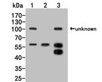 PNLIP Antibody in Western Blot (WB)