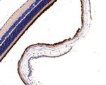 PDE6A Antibody in Immunohistochemistry (Paraffin) (IHC (P))