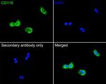 CD116 Antibody in Immunocytochemistry (ICC/IF)