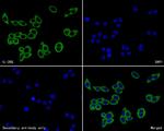 IL2RG Antibody in Immunocytochemistry (ICC/IF)