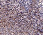 IL2RG Antibody in Immunohistochemistry (Paraffin) (IHC (P))