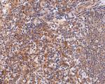 IL2RG Antibody in Immunohistochemistry (Paraffin) (IHC (P))