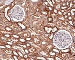 IL20RA Antibody in Immunohistochemistry (Paraffin) (IHC (P))