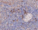 IL21R Antibody in Immunohistochemistry (Paraffin) (IHC (P))