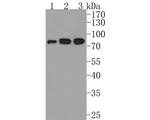 IL21R Antibody in Western Blot (WB)