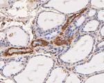 GAB2 Antibody in Immunohistochemistry (Paraffin) (IHC (P))