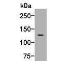 MYT1L Antibody in Western Blot (WB)