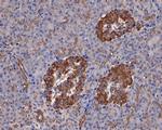 ATGL Antibody in Immunohistochemistry (Paraffin) (IHC (P))