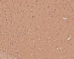 PLCB1 Antibody in Immunohistochemistry (Paraffin) (IHC (P))