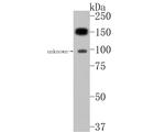 PLCB1 Antibody in Western Blot (WB)