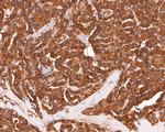 IL5RA Antibody in Immunohistochemistry (Paraffin) (IHC (P))