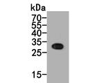 MMP7 Antibody in Western Blot (WB)