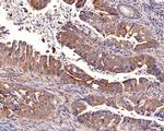 SOCS4 Antibody in Immunohistochemistry (Paraffin) (IHC (P))