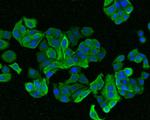 AMHR2 Antibody in Immunocytochemistry (ICC/IF)