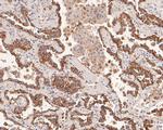 AMHR2 Antibody in Immunohistochemistry (Paraffin) (IHC (P))