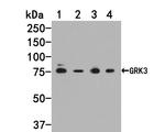 GRK3 Antibody in Western Blot (WB)