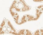 ARIH2 Antibody in Immunohistochemistry (Paraffin) (IHC (P))