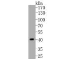 B3GAT1 Antibody in Western Blot (WB)