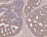 PFKP Antibody in Immunohistochemistry (Paraffin) (IHC (P))