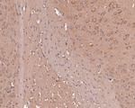 PFKP Antibody in Immunohistochemistry (Paraffin) (IHC (P))