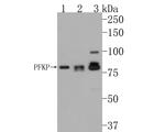 PFKP Antibody in Western Blot (WB)