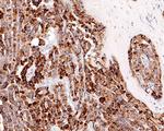 P-Glycoprotein Antibody in Immunohistochemistry (Paraffin) (IHC (P))