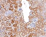 P-Glycoprotein Antibody in Immunohistochemistry (Paraffin) (IHC (P))