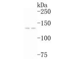 P-Glycoprotein Antibody in Western Blot (WB)