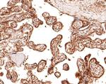 TIF1 gamma Antibody in Immunohistochemistry (Paraffin) (IHC (P))