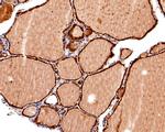 TIF1 gamma Antibody in Immunohistochemistry (Paraffin) (IHC (P))