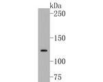 TIF1 gamma Antibody in Western Blot (WB)