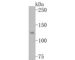 TIF1 gamma Antibody in Western Blot (WB)