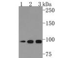 AP2A2 Antibody in Western Blot (WB)