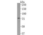 CNGA3 Antibody in Western Blot (WB)