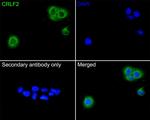 TSLP Receptor Antibody in Immunocytochemistry (ICC/IF)